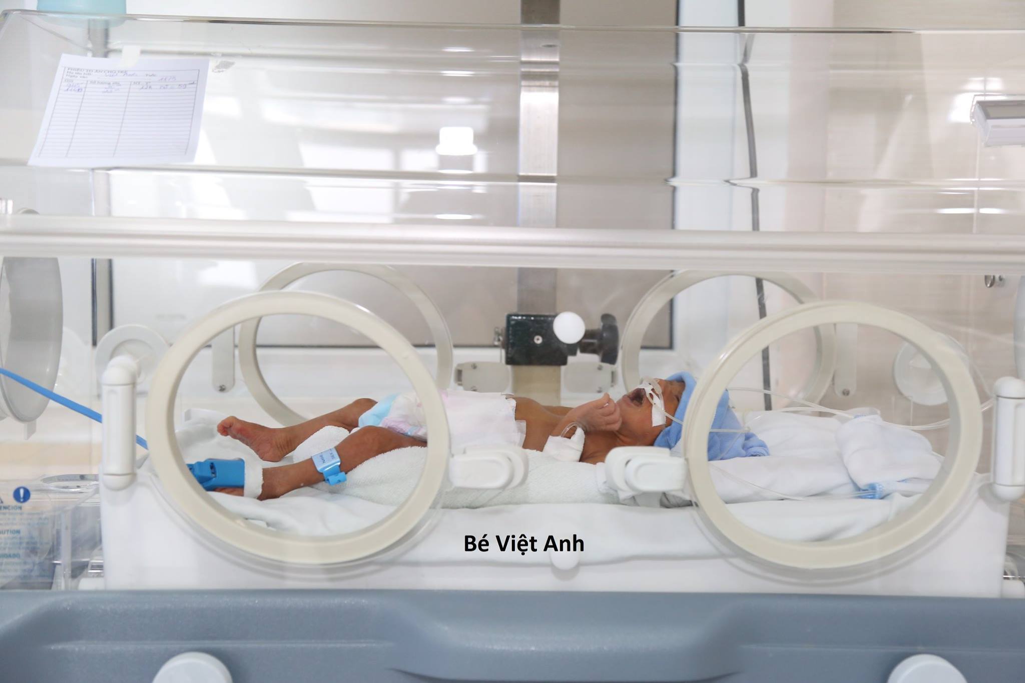 Hai bé sơ sinh tội nghiệp bị hai người mẹ bỏ rơi tại bệnh viện