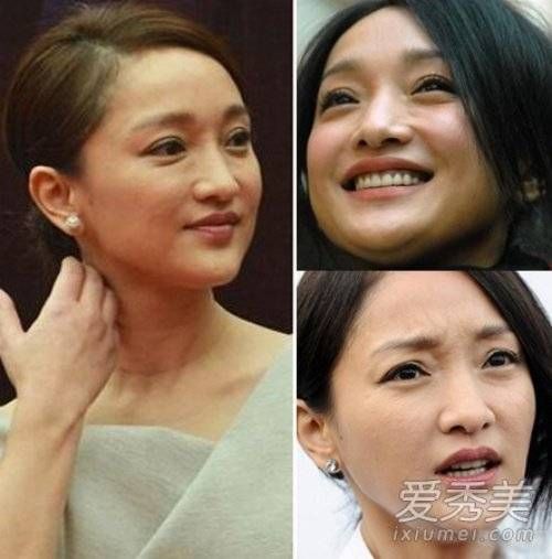 Châu Tấn từng được mệnh danh là người đẹp trẻ thơ. Nhưng đó đã là chuyện quá khứ khi giờ đây cô không thể che lấp vùng mắt đầy nếp nhăn, làn da không căng mịn của mình.
