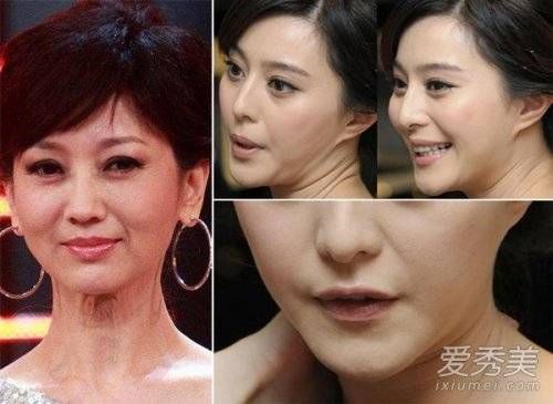 Triệu Nhã Chi và Phạm Băng Băng là hai đại giai nhân của làng giải trí Hoa ngữ. Nhưng có thể thấy, dù họ đẹp hoàn hảo, vùng da dưới cổ nhăn nheo đã cho thấy thời gian không buông bỏ bất kỳ ai.