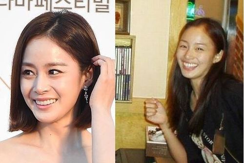 Kim Tae Hee cũng mât điểm vì răng to và hơi vẩu khiến hàm răng dường như choáng ngợp gương mặt mỗi khi cười. Hiện tại, diện mạo của bạn gái Bi Rain được nhận xét hoàn hảo.