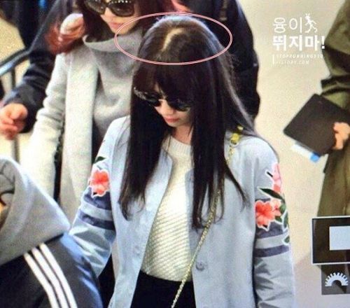 Thành viên Yoona của nhóm SNSD lộ cả mảng da đầu khá rõ khi xuất hiện ở sân bay.