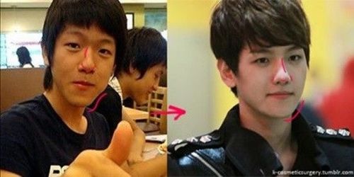 Baekhyun (EXO) và màn lột xác bất ngờ cùng nghi án phẫu thuật thẩm mỹ cằm và mũi.
