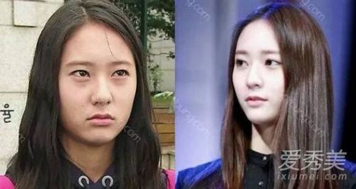 Không chỉ vậy, cô bị đặt câu hỏi thẩm mỹ vì góc hàm dưới khác hẳn hình ảnh cũ trong quá khứ. Hình ảnh so sánh làm rộ tin đồn cô hút mỡ mặt.