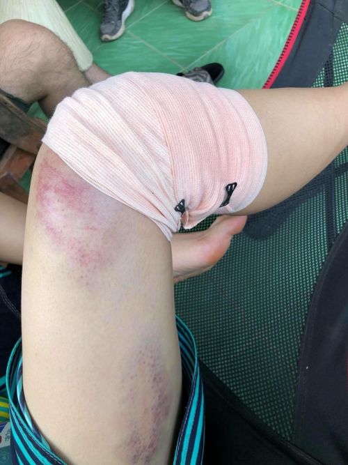 Vết thương được chuẩn đo&aacute;n phải mất &iacute;t nhất 1 th&aacute;ng để b&igrave;nh phục ho&agrave;n to&agrave;n khiến người h&acirc;m mộ v&ocirc; c&ugrave;ng lo lắng.