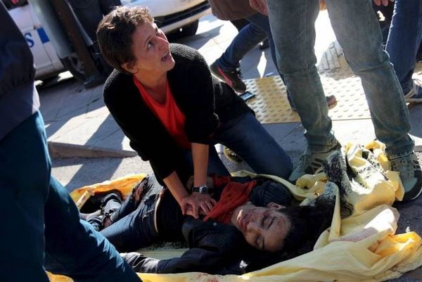 ss-151010-turkey-explosion-mn-04.nbcnews-ux-1024-900