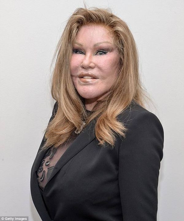 Jocelyn Wildenstein từng bỏ ra 4 triệu USD để chỉnh sửa dung nhan nhưng hậu quả là gương mặt trở thành “mặt mèo”. Có nguồn tin tiết lộ, Jocelyn muốn dao kéo để níu giữ chồng là tỷ phú Alec Wildenstein nhưng thất bại. Cặp đôi chia tay vào năm 1997.