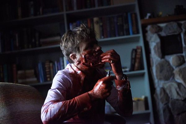 HANNIBAL -- "Tome-wan" Episode 212 -- Pictured: Michael Pitt as Mason Verger -- (Photo by: Sophie Giraud/NBC)