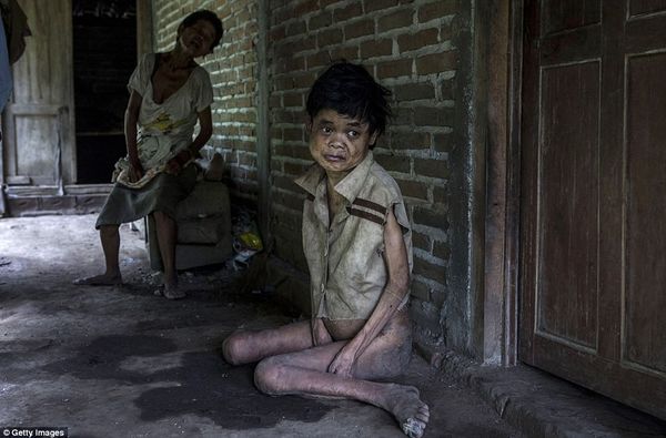Sinem, người bị hội chứng Down ngồi trên sàn nhà ẩm ướt tại Krebet, Jambon, Indonesia