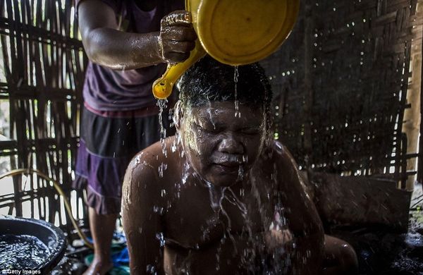 Andika, 17 tuổibị hội chứng Down đang được mẹ Supini giúp đỡ tắm tại làng Sidoarjo