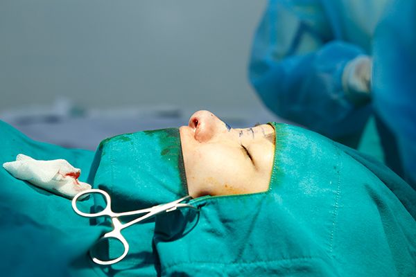 Lộ ảnh vợ cũ Lâm Vinh Hải phẫu thuật mũi và tiêm môi Lộ ảnh vợ cũ Lâm Vinh Hải phẫu thuật mũi và tiêm môi