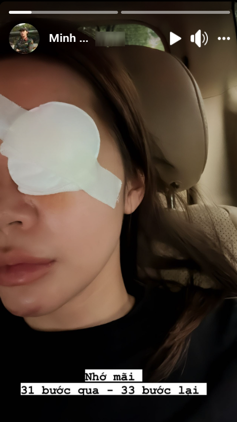  Minh Tú tiếp tục gây lo lắng hậu bị tai nạn phải khâu hơn 10 mũi: Hết cằm lại tới mắt! Ảnh 1